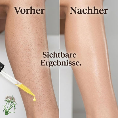 Cyperus Rotundus Oil Zur Haarentfernung, Cyperus Rotundus Öl Reduziert Eingewachsene Haare Nach Der Rasur, Natürliches Körper & Gesicht Hair Removal Cyperus Oil, Leichtes & Sanfte Körperpflege, 2PCS